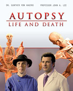 Autopsy Life and Death DVD Box Set on Amazon.com